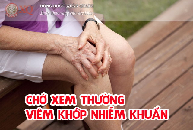 Chớ xem thường viêm khớp nhiễm khuẩn