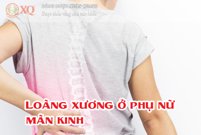 Loãng xương ở phụ nữ mãn kinh
