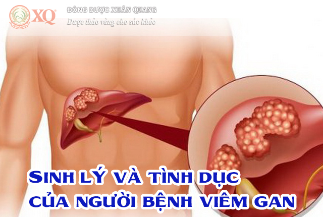 Sinh lý và tình dục của người bệnh viêm gan