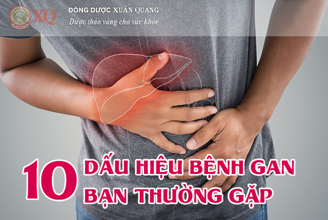 10 DẤU HIỆU BỆNH GAN BẠN THƯỜNG GẶP