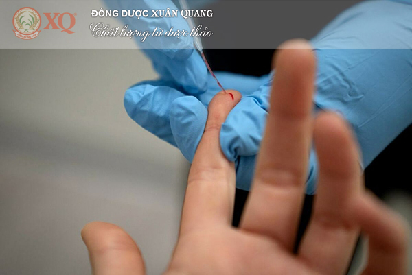 NGƯỜI KHỎI COVID-19 CÓ TÁI NHIỄM KHÔNG?